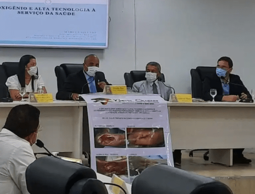 Itabuna aumenta a oferta de sessões de Oxigenoterapia Hiperbárica