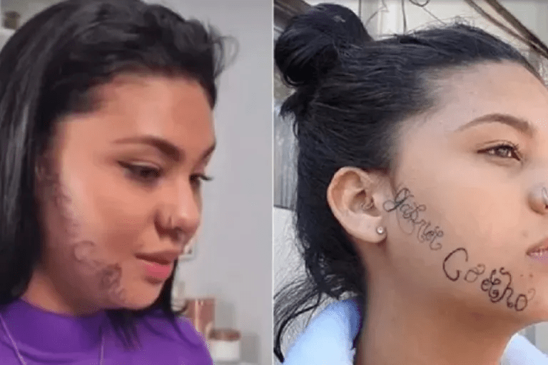 Jovem que teve o rosto tatuado à força pelo ex-namorado, ganha tratamento para remoção