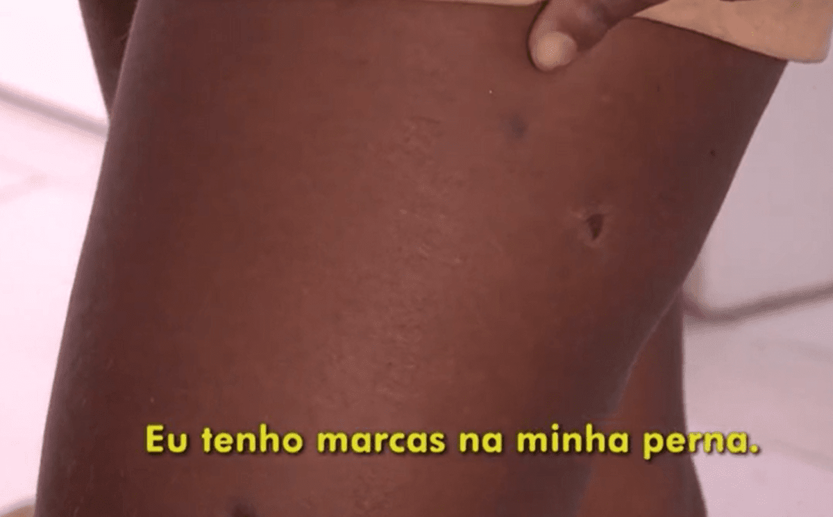 M&eacute;dicos que atuaram em Itabuna acusados de circurgias mal feitas foram  destaque no fant&aacute;stico deste domingo &mdash; Ilh&eacute;us Eventos